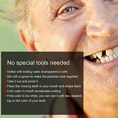 Teeth Repair Beads for Missing Tooth Filling, 10g L16285
